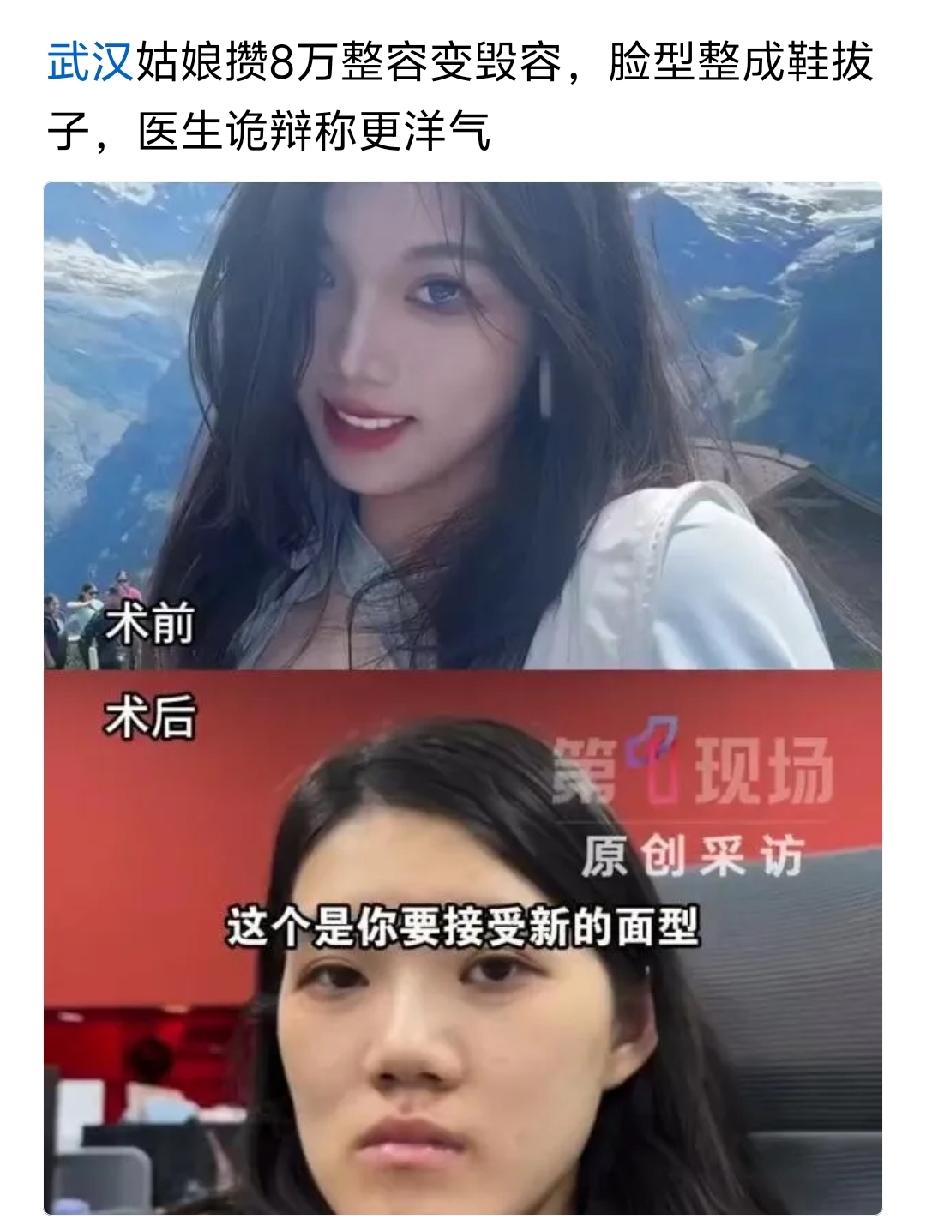 整形失败了，还能再调整回来吗？