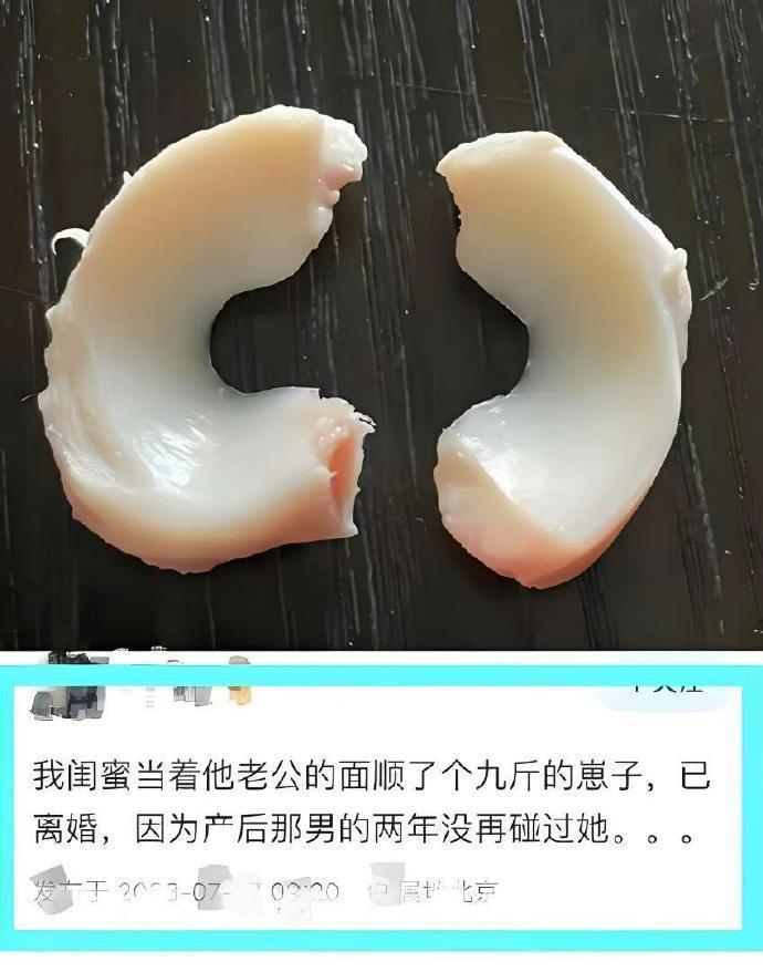 卧槽...瞬间对生育真相汗毛起立。。。