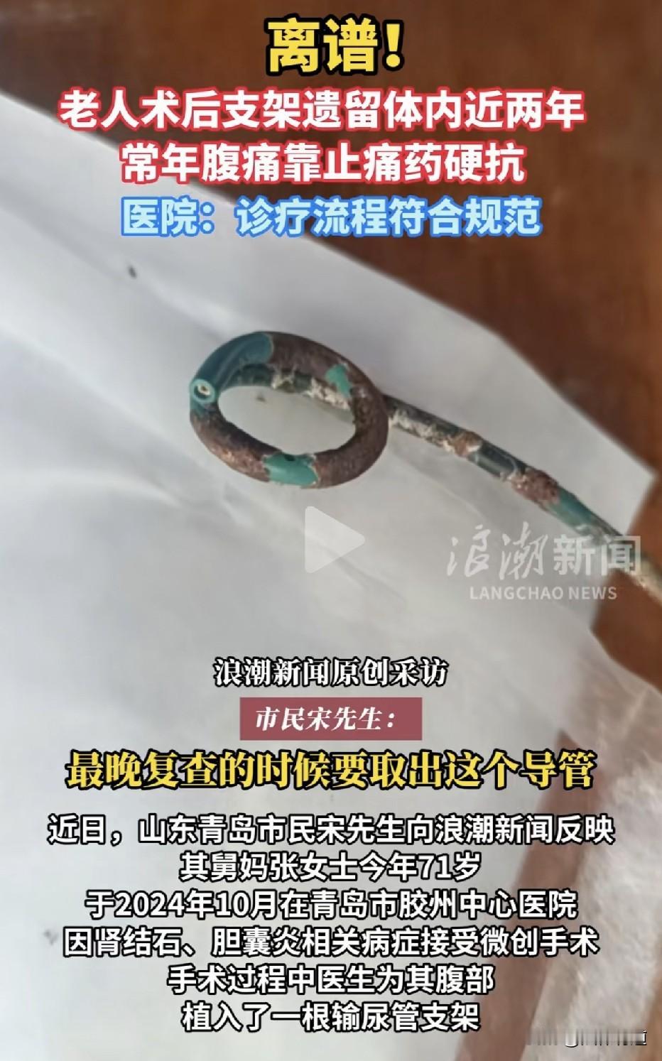 术后支架竟然遗留体内近两年，常年腹痛靠止痛药硬扛。医院：是她复查做了彩超，自己没