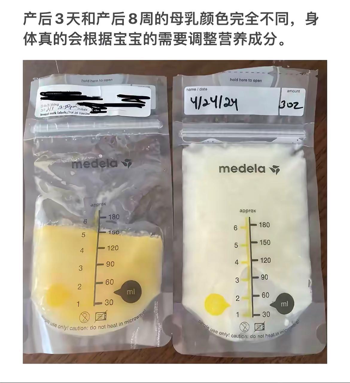 产后母乳变化大，营养调整要跟上！