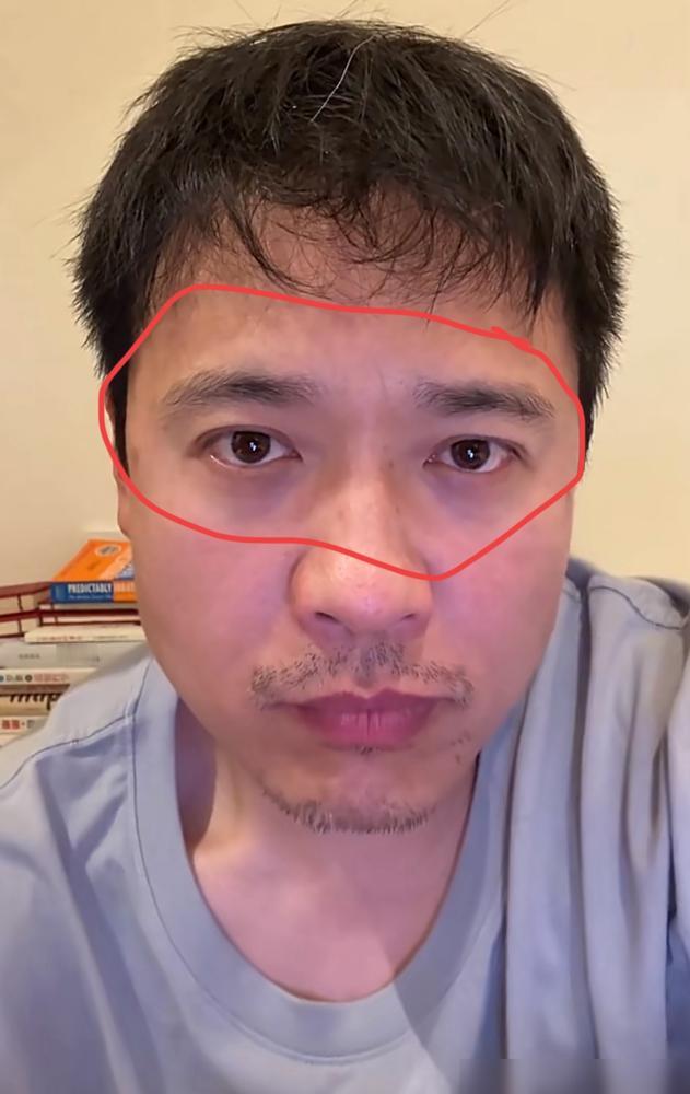 高云翔发视频澄清，可谁还听内容？镜头怼脸，黑眼圈深得像俩坑，法令纹耷拉着，眼神空