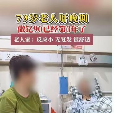 79岁肝癌晚期老人依靠钇90微创疗法安稳度过三年，术后副作用微弱、病情没有复发，