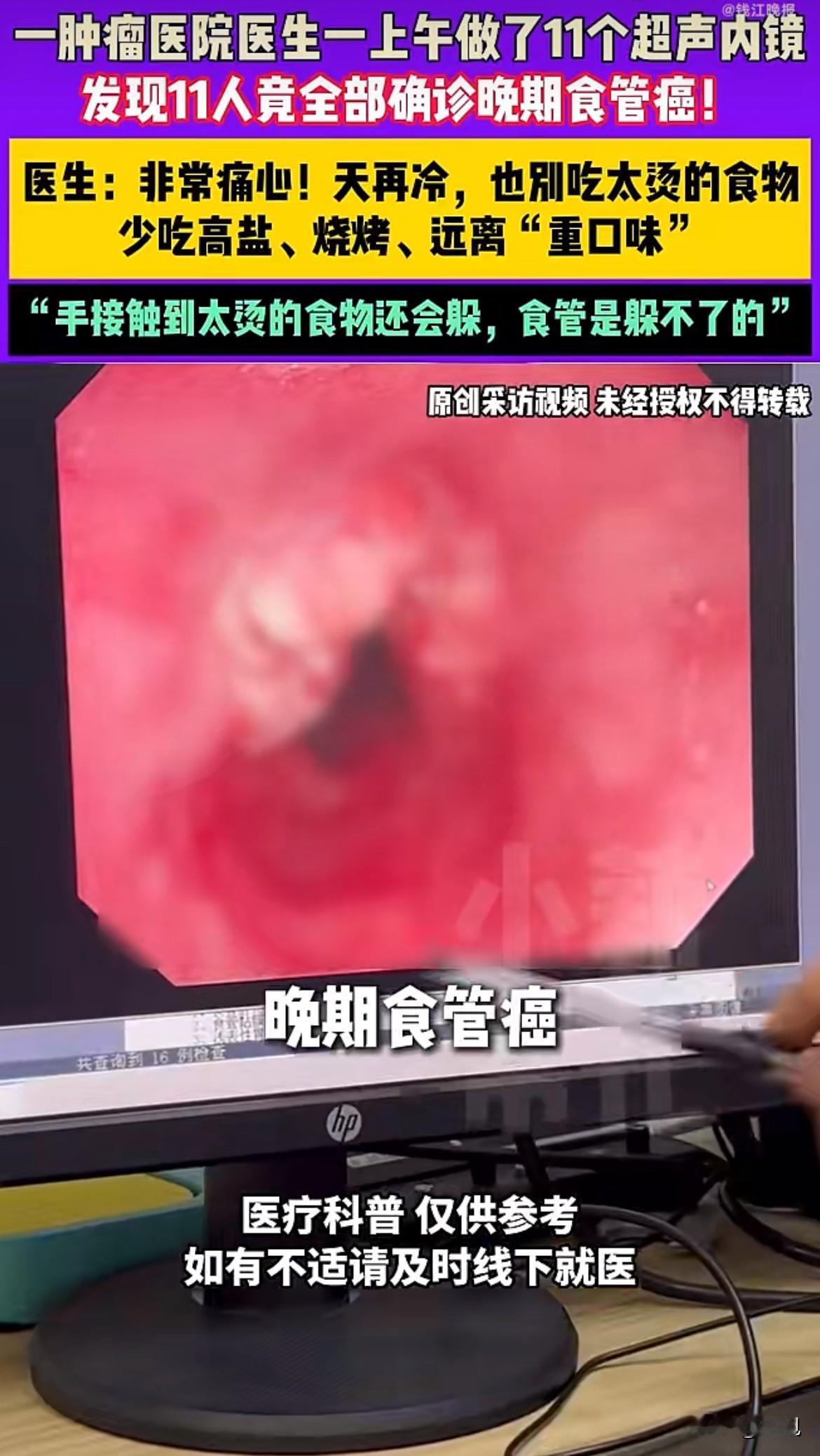 一上午，11个人，全部晚期食管癌。这是河南一家肿瘤医院真实的检查结果。医生痛