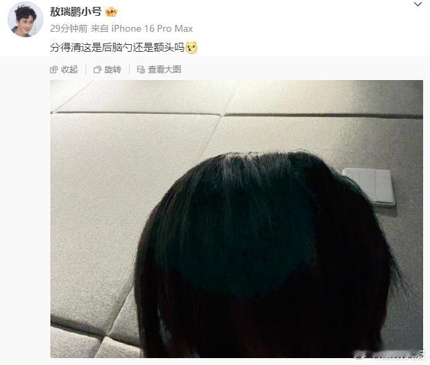 敖瑞鹏这是后脑勺还是额头都这样问了，我猜肯定是额头！说明头发太长了，挡住帅气的