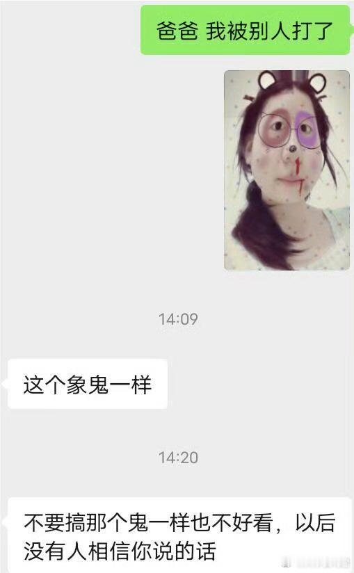 假装自己被打了，被爸爸这样说​​​​