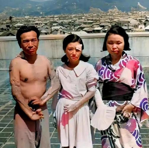 1945年，广岛原子弹爆炸后，三个幸存者，留下了这一张照片，镜头中的他们眼神非常