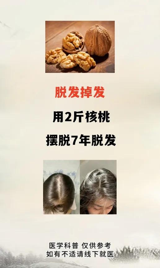 脱发掉发用2斤核桃摆脱7年脱发我在上学的时候结识过一位无二无人的老中医前