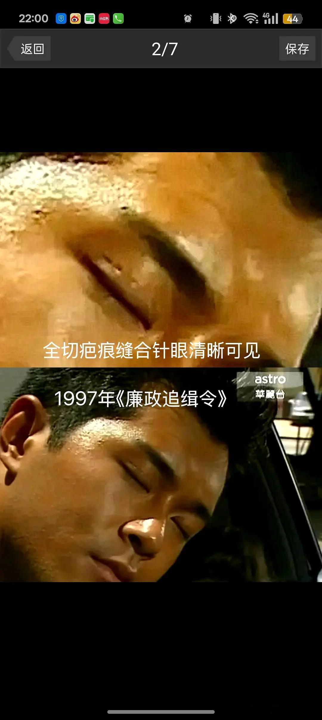 古天乐和金城武应该是整容最成功的男明星了吧