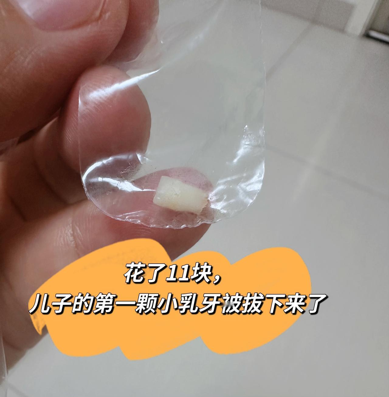 儿子乳牙一直不掉，然而恒牙已经冒出来了。没办法，只能去医院了。给医生看了