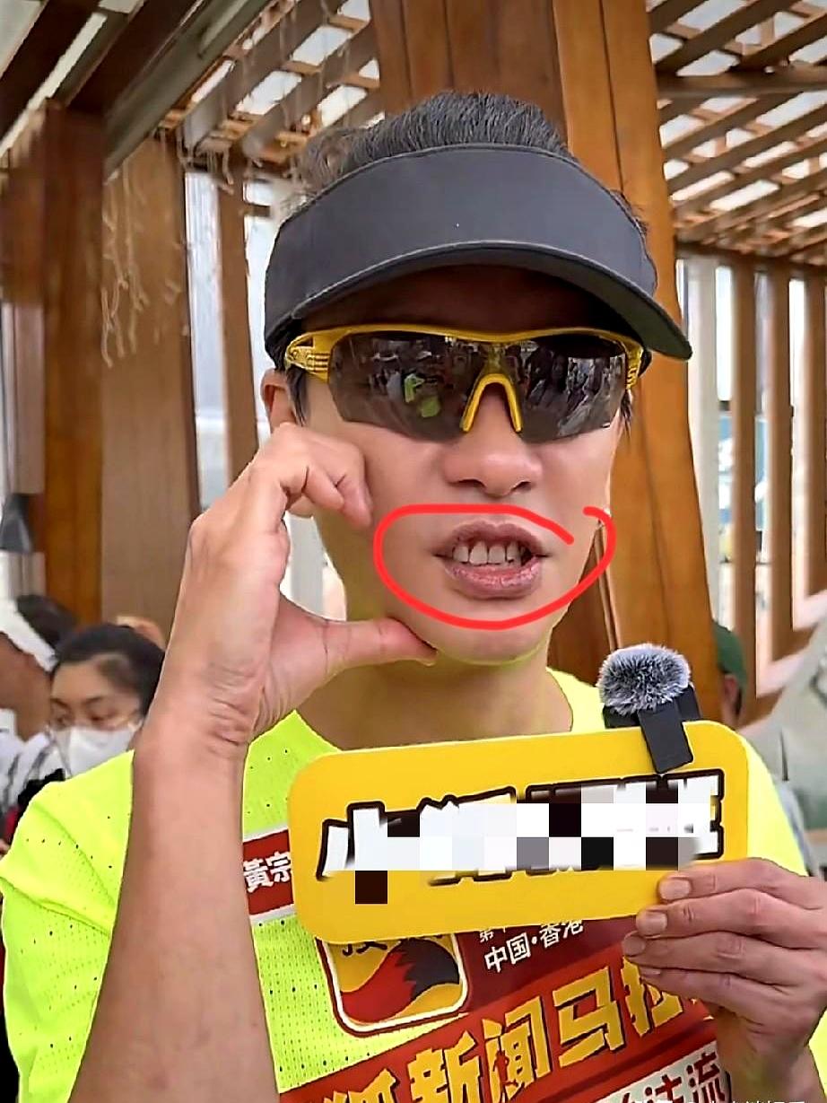 都说黄宗泽牙不好影响颜值，我特意问了口腔科朋友。结果他说，这事儿根本不是钱的事