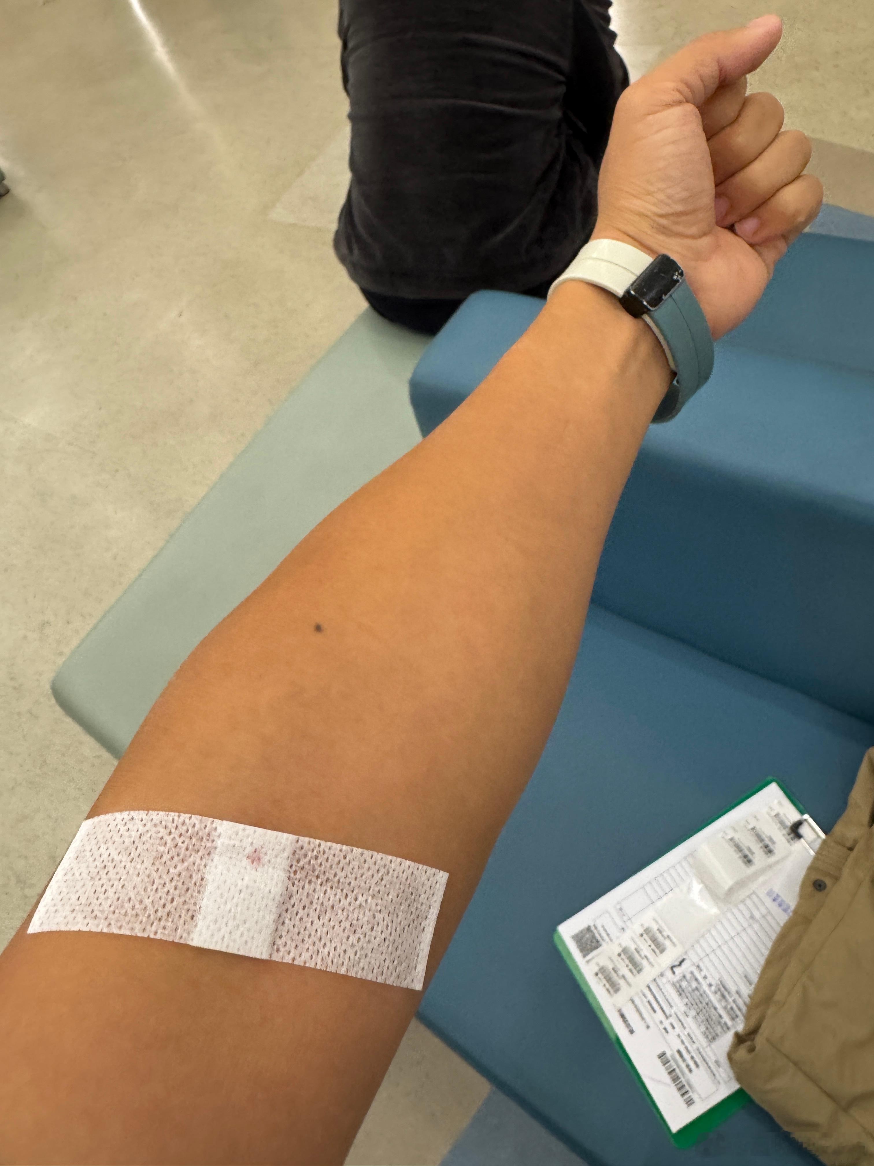 瘦到血管都不清晰了[捂脸哭][捂脸哭][捂脸哭]护士一直跟我说抱歉，扎了两针​​​