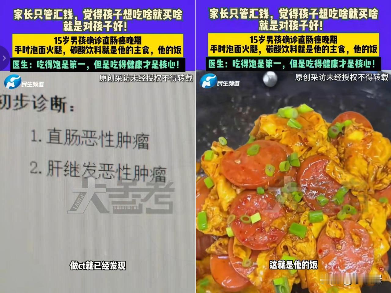 河南那15岁男孩直肠癌晚期，肝上全是肿瘤，看完真揪心！医生一问病因，
