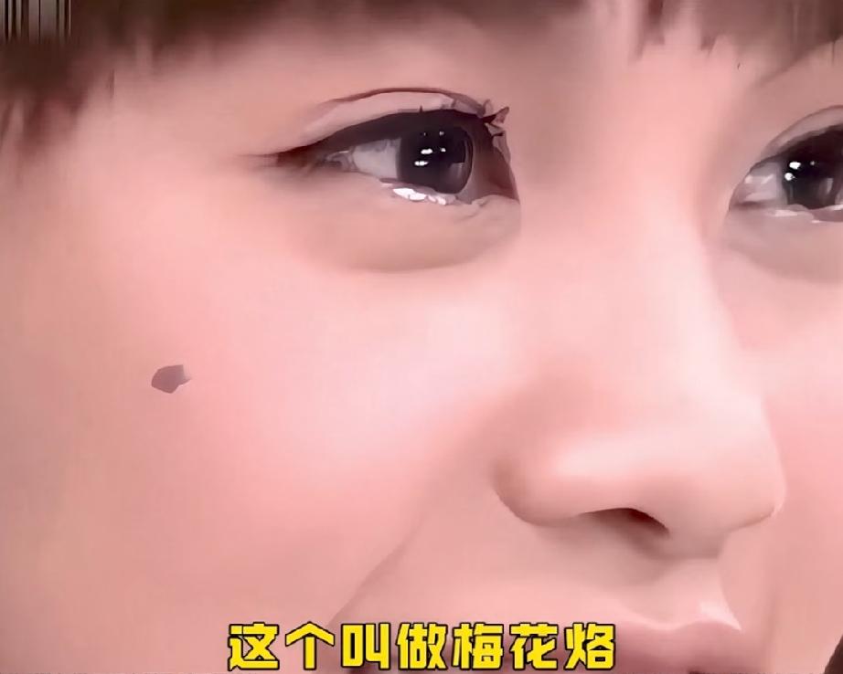 杨丞琳脸上的痣，张菲说千万不能点掉五角星形的，这种痣千万分之一的概率，注定不