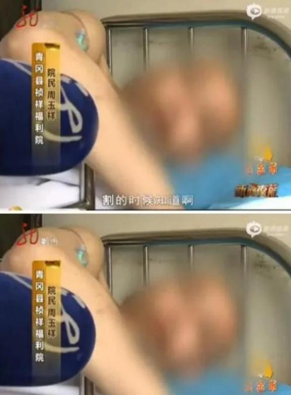 2024年，黑龙江某敬老院，四名老年男性被割去了生殖器，当警方调查后揭露施害者身