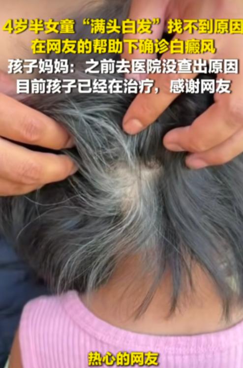 网友的含金量还在上升！近日，贵州一位宝妈发帖求助，自己4岁女儿出现了大量白发