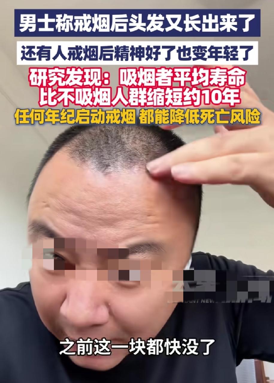 戒烟有这么多好处你知道吗？陕西一男子分享戒烟后的亲身经历，他说戒烟后原本头顶稀