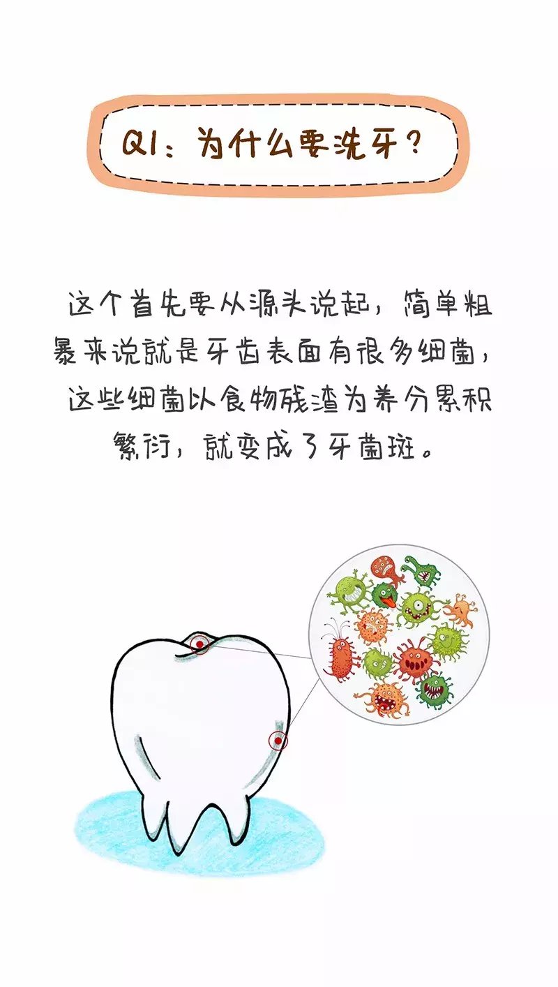 你的所有洗牙困扰, 看这一篇就够了!