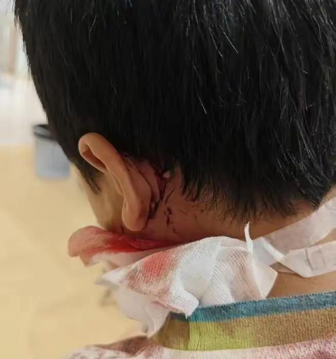江西南昌，9岁男孩暑假去同学家串门，却被拴在进门处的大狗咬伤，治疗就花了1万4，