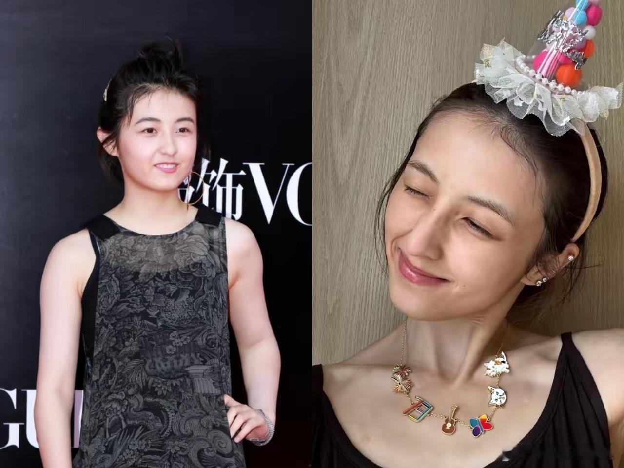 女明星里，我最想不通的就是张子枫了，你说她才25岁，难道没有人告诉她，太瘦了真的
