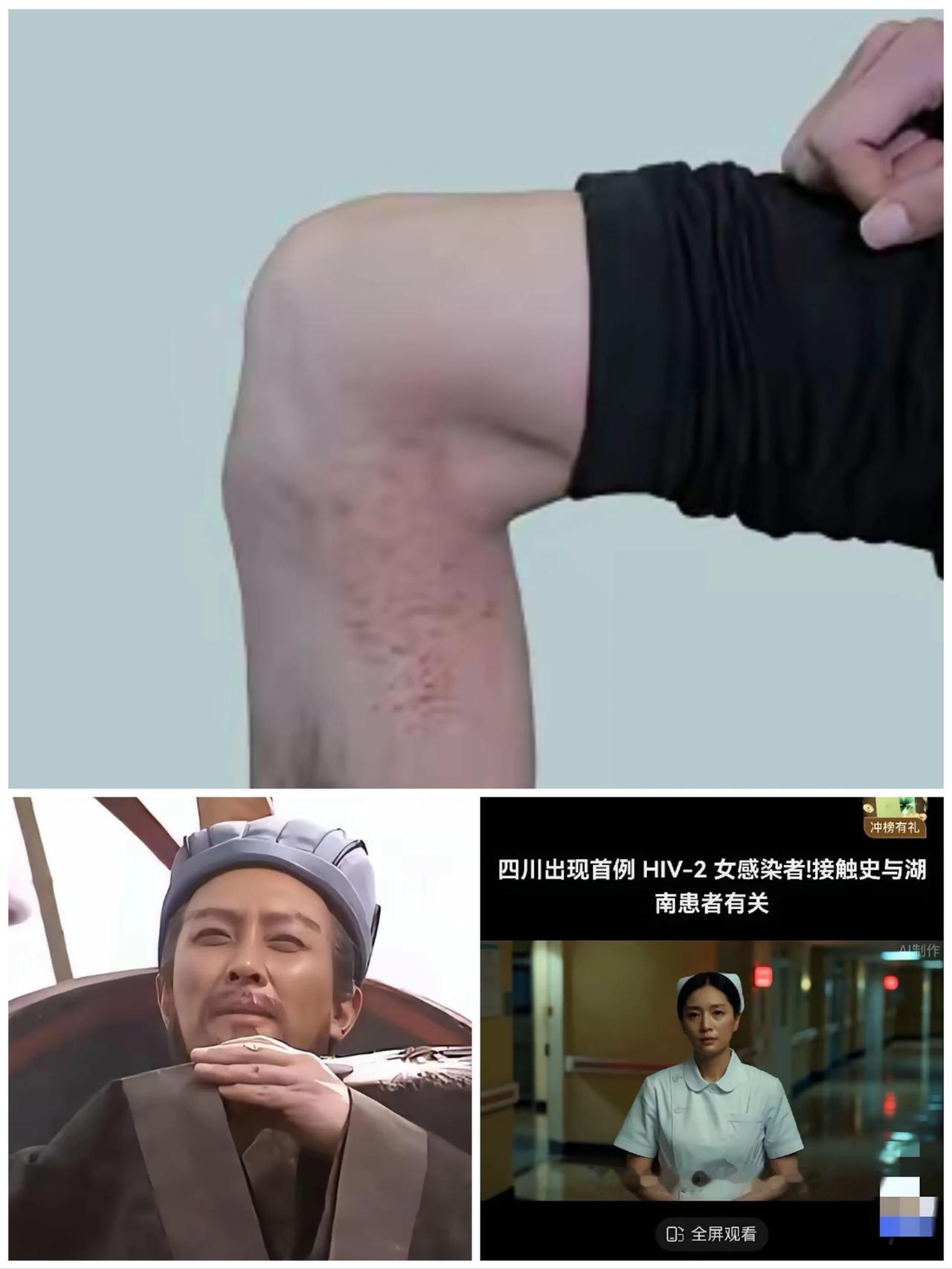 传染和给这女的艾滋病毒的男子，一个月前刚刚死去，结果这女的又“交流”了八个人！有