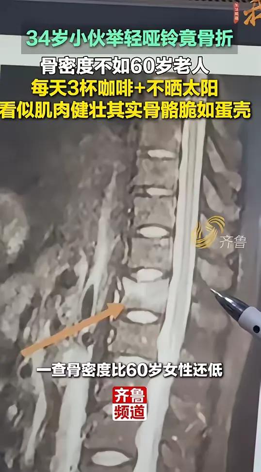 悲剧还是发生了！近日，浙江，一男子经常健身，看着很健康，却在健身房举哑铃时，竟然