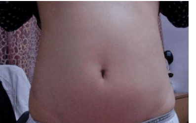 90后女孩怀孕3个月, 肚子没了动静, 医生检查孩子没了