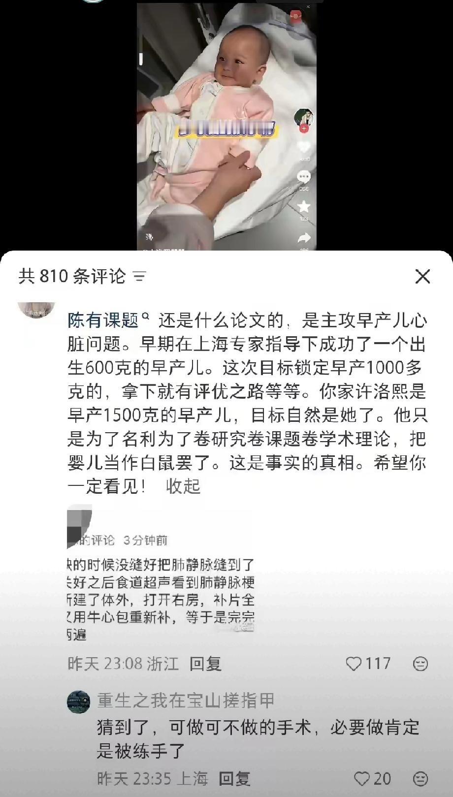 这是把小洛熙当小白鼠吗？这也太可怕了吧如何看待宁波女婴”心脏手术离世“事件