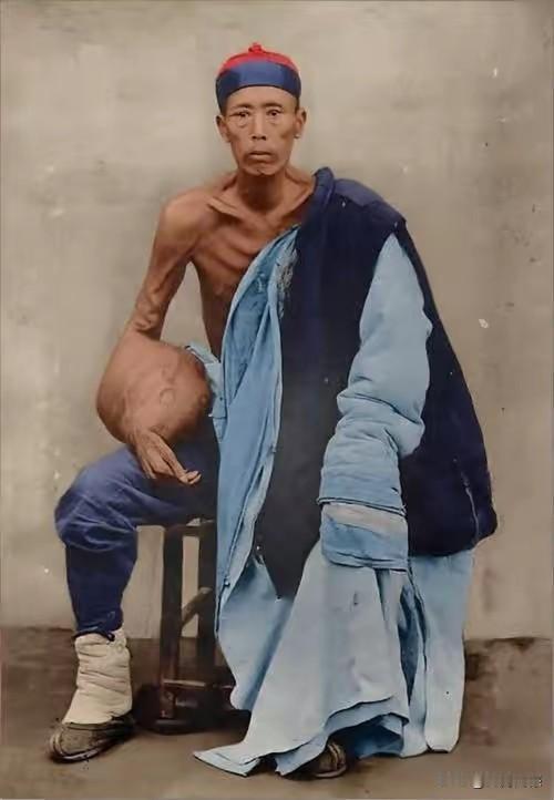 当时的人得了这样的毛病，以当时的医疗条件，恐怕是很难治好的，通过照片可以看得出来