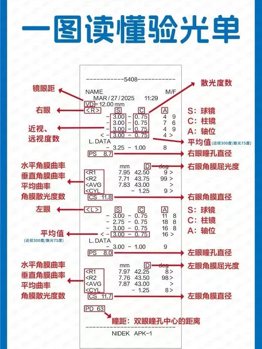 验光单怎么看度数？ds近视，dc散光意思解析✅