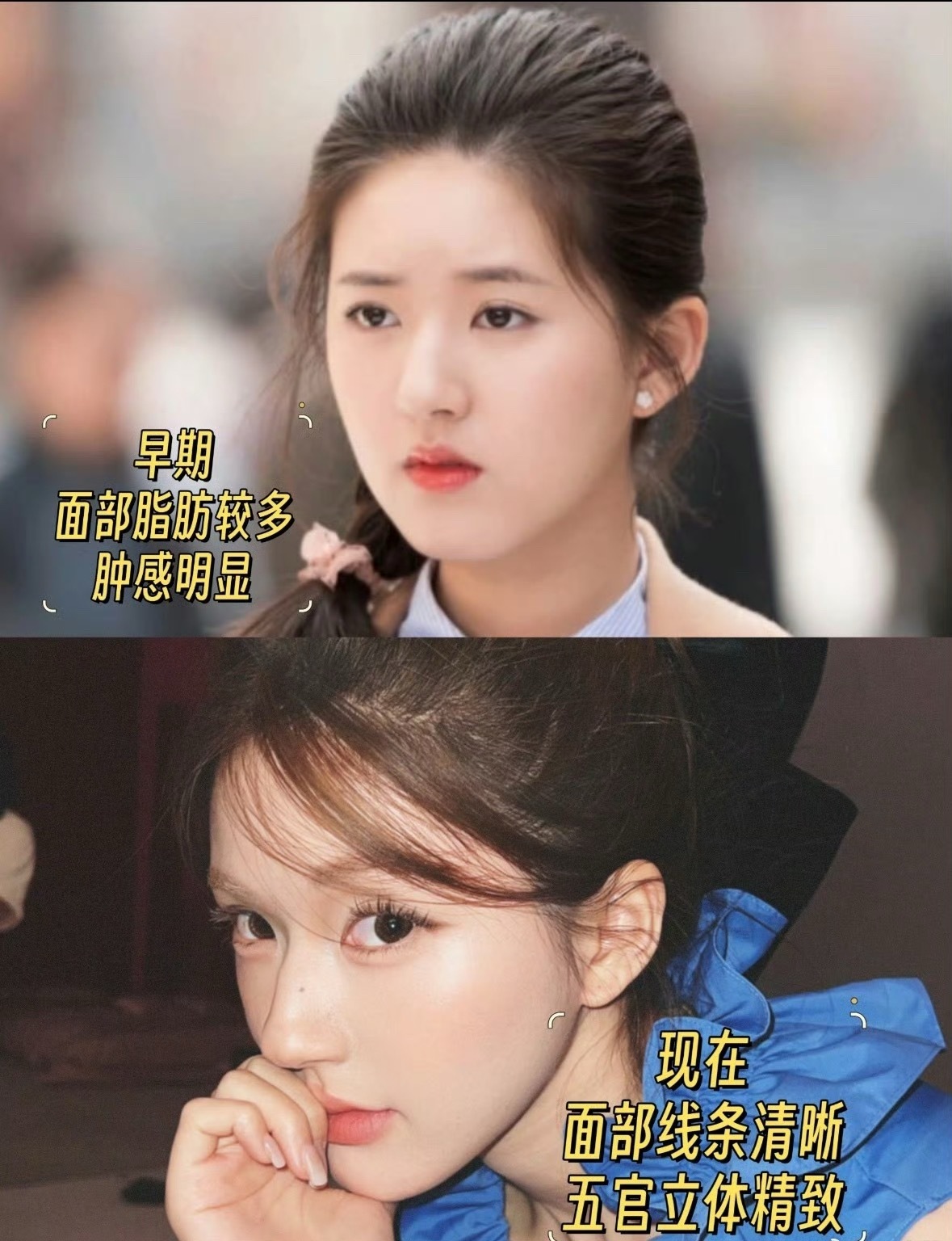 赵露思问整容犯法吗整容确实也没啥爱美之心人皆有之但是别自己把自己给骗了就行​
