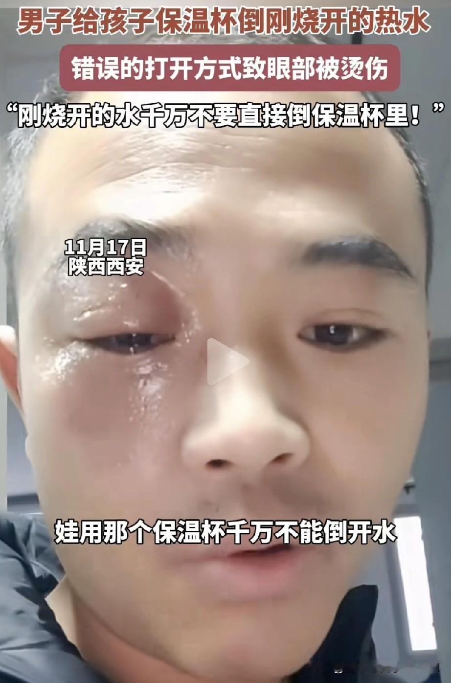 男子向网友分享经验，孩子的保温杯千万不能倒开水，否则十分危险。原来，男子把水烧