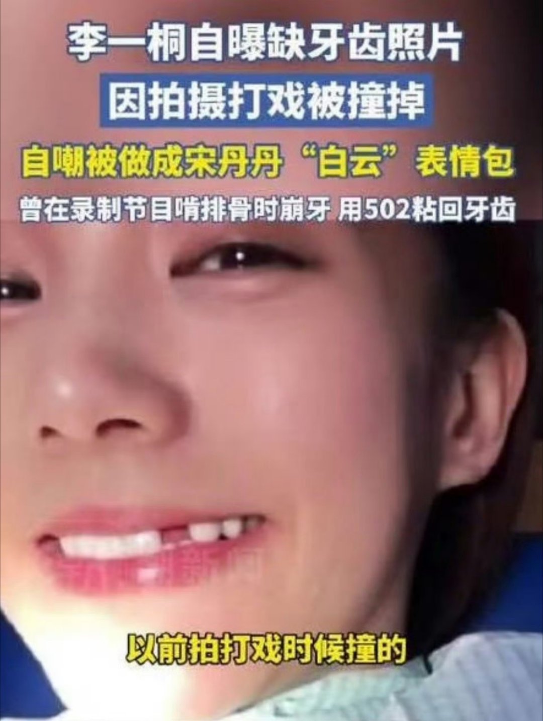 李一桐被磕掉了一颗牙上次被爬蜈蚣的也是她吧！！我嘞个天选倒霉蛋女主[捂脸哭][允悲