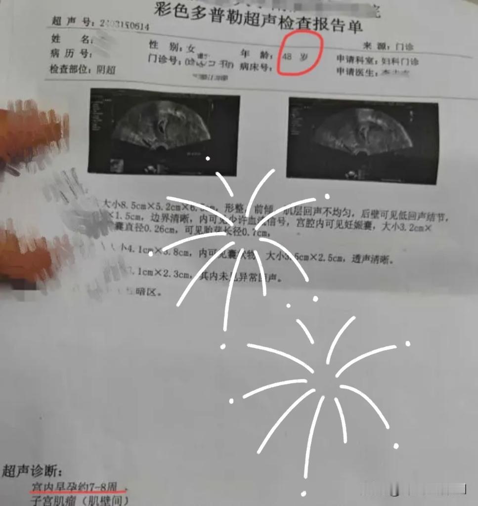 天啦噜!我一个48岁的女同事怀孕了!这同事原来只生了一个女儿(女儿今年24