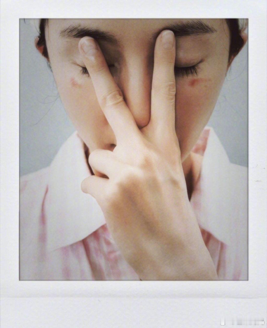 杨幂脸被蒸汽眼罩烫伤了天！！蒸汽眼罩这么危险吗！姐真的是一如既往什么都喜欢用幽