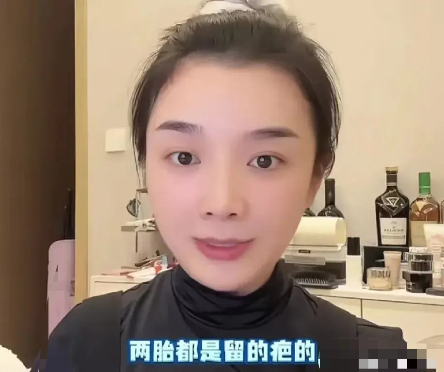 吴雅婷痛两次剖腹产，在子宫上留下的不仅是伤疤，更是难以愈合的健康隐患——子宫憩室