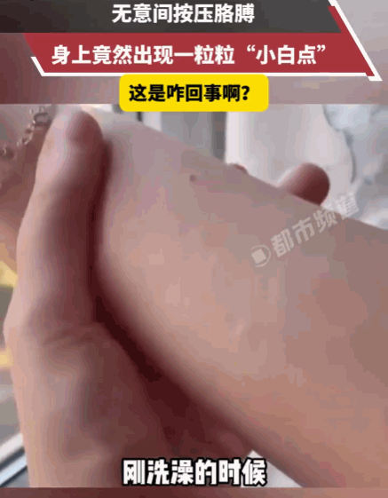 看着太瘆人！河南，一网友刚结束沐浴，热气蒸腾的浴室里，他无意间用手指按压了一下自