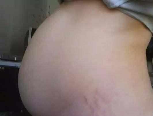 准妈妈预产临近的时候, 被检查出是“无脑儿”