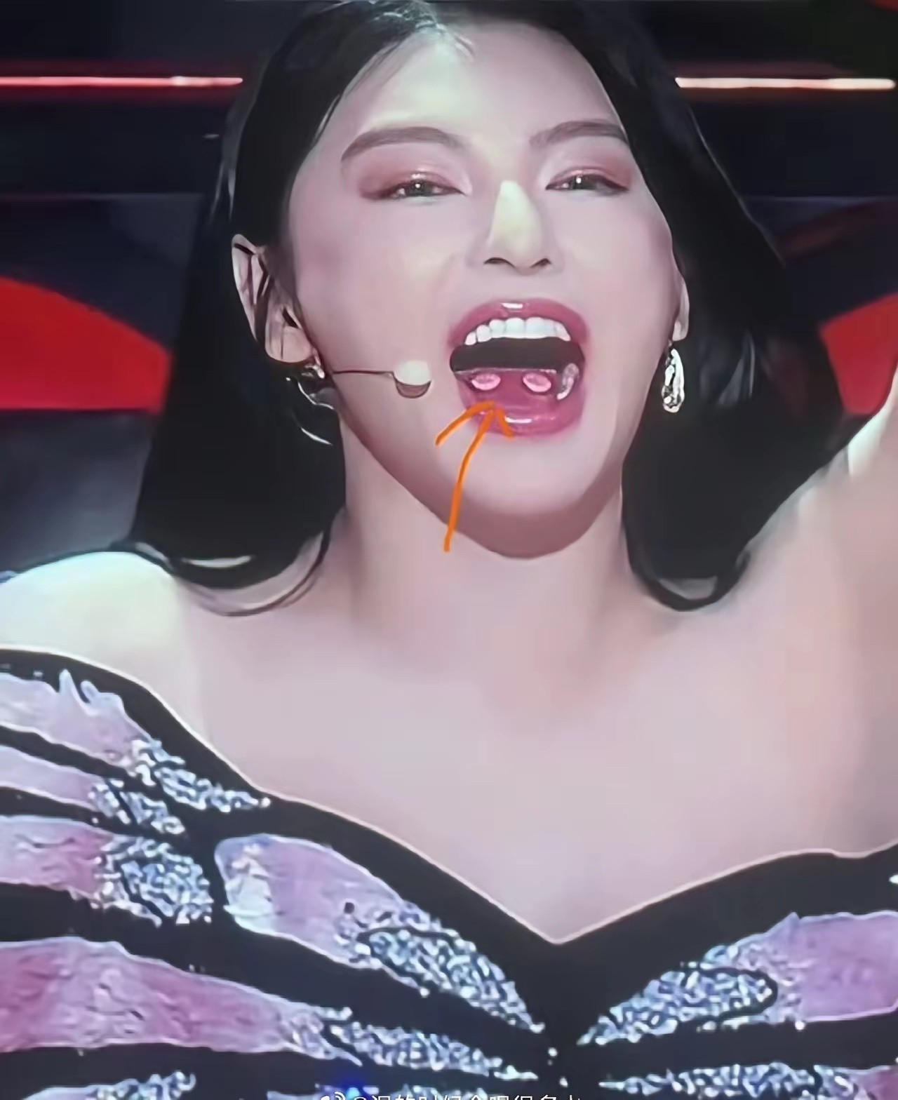 不懂就问，张雨绮舌头上这是什么东西