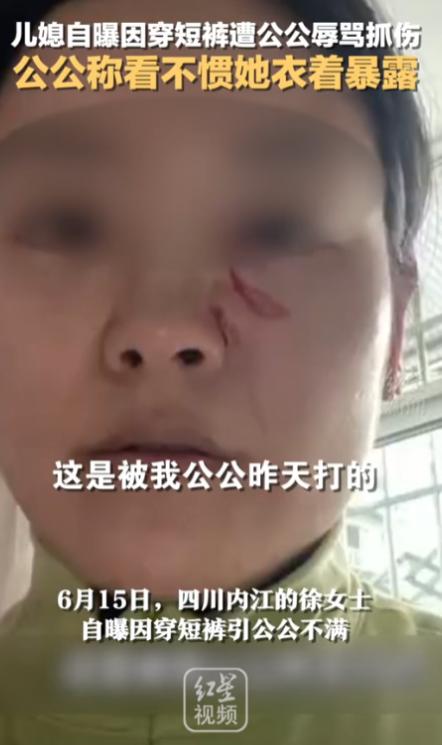 “清官难断家务事！”四川，一儿媳因天气热穿了条白色短裤，竟被50多岁的公公指着鼻