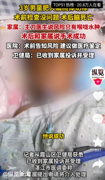 太巧，监控刚好缺失！湛江本地医院，做了5小时扁桃体切除，结果第二天就脑死亡，母亲