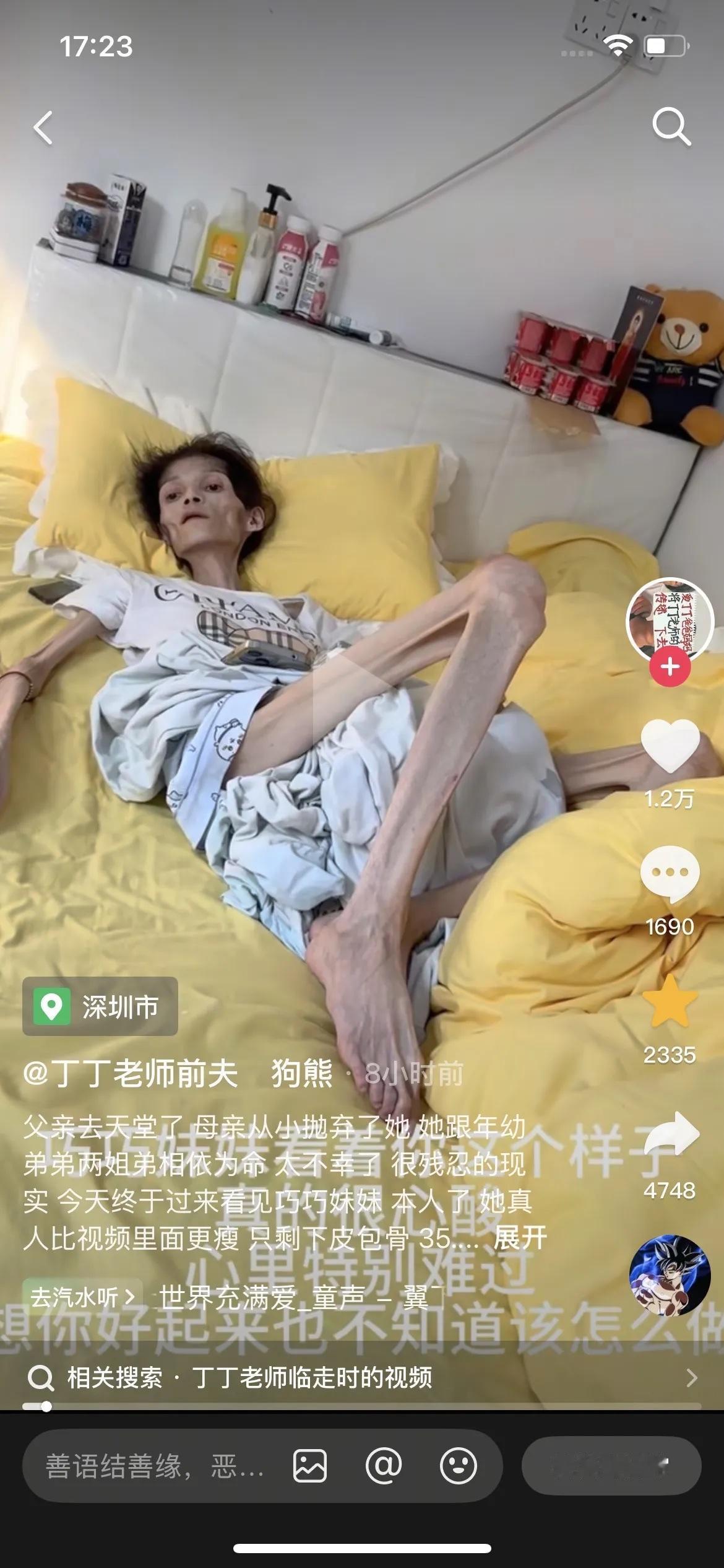 最可怜的胃病患者，比胃癌也可怕。女孩才27岁，体重只有五六岁小孩更么重了，这才叫