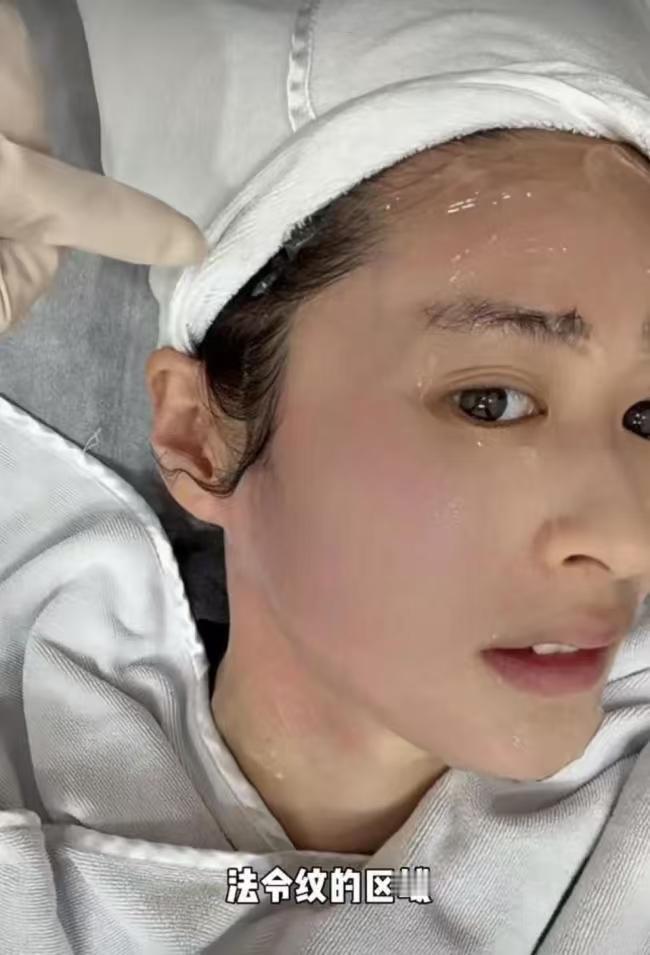 颖儿做眼部热玛吉疼哭了近年来，女星们为了维持美貌不惜一切代价，颖儿便是其中之