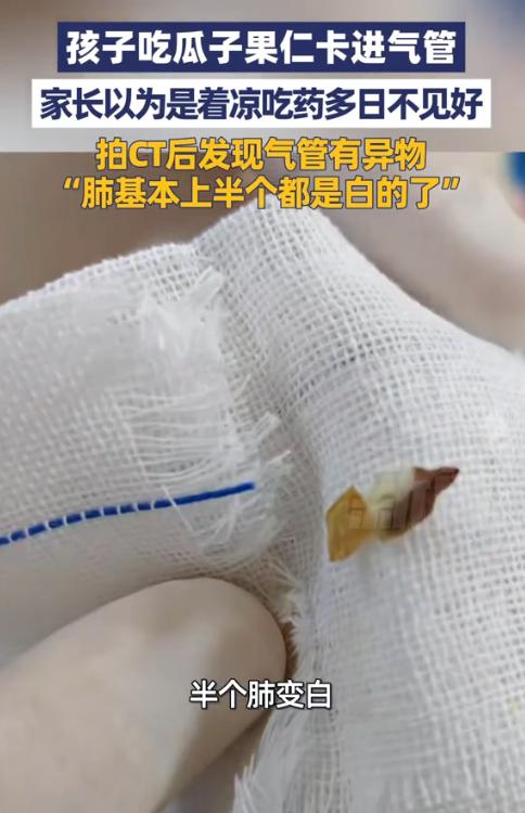 “悲剧还是发生了！”近日，一3岁男童在吃瓜子时突然摔倒，第二天，就出现咳嗽低烧的