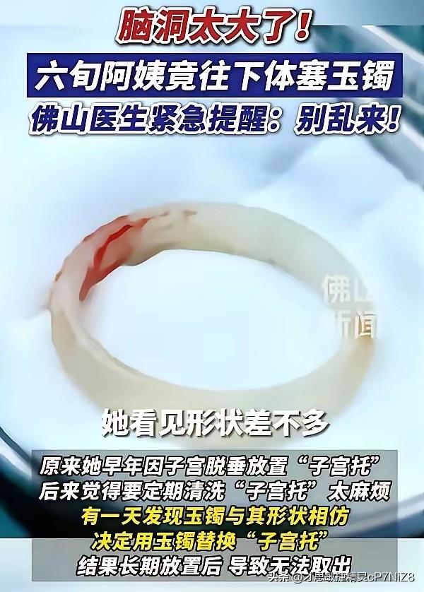 “聪明反被聪明误！”广东，一65岁阿姨因为“阴道异物”去医院检查，结果医生发现里