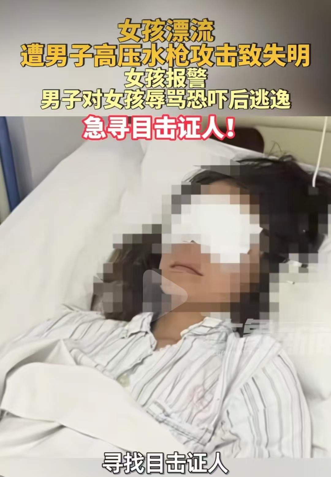 女孩6月7日在山东潍坊玩漂流，竟然被人用水枪攻击右眼挫伤积血！6月7日下午，刚