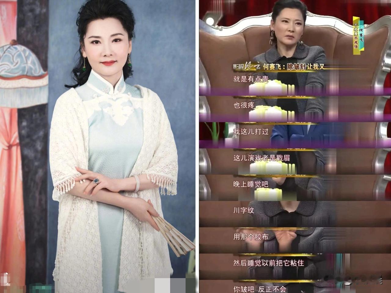 “何赛飞聊医美也太实在了！”说打除皱针好是好，就是又贵又疼，她之前为消川