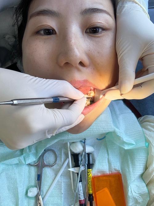 中国科技全面暴发，四大黑科技来了：一、牙齿再生技术，科学家成功找到牙齿生长开