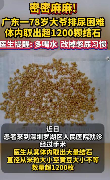 “简直目瞪口呆！”7月31日观海视频报道，广东深圳，一78岁大爷排尿困难，被折磨