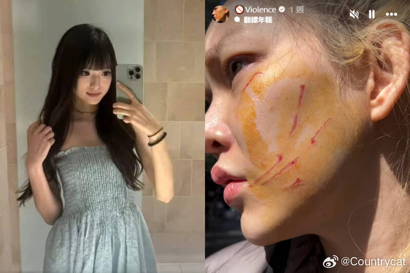 【泰国网红悉尼遭中国女子暴打脸部受伤险被热汤泼伤】海外新鲜事泰国网红Babb