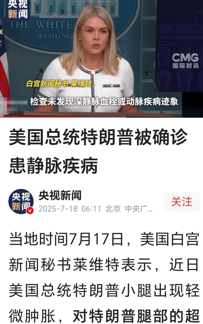 实在是笑不活了，我们中国人是真的太热情了。特朗普被确诊静脉曲张，评论区里都是分